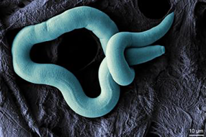 electron micrograph of L. crenatae